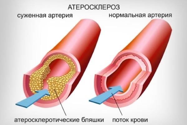 Постоянно хочется спать: утром, днем и вечером. Причины слабости и что делать