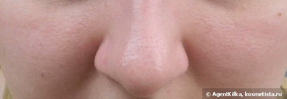 Бьюти-батл 3х средств для уменьшения пор: Benefit The Porefessional, Etude House Goodbye Pore Ever и Tony Moly Egg Pore