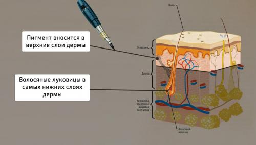 Выпадают ли ресницы после межресничного татуажа. У меня выпали все ресницы после татуажа