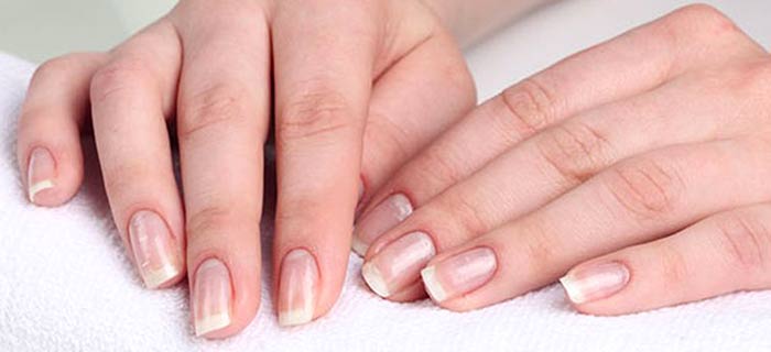 Белые пятная на ногтях, причины и лечение