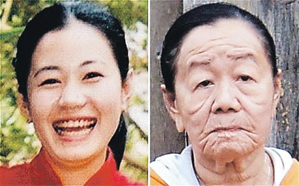 За пару дней 23-летняя вьетнамка Нгуен превратилась из красавицы в старуху. 