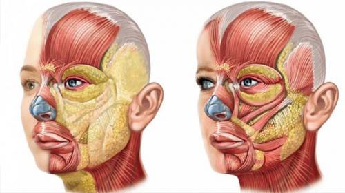 Сколько проходит отек лице после удара. Лечение гематомы и отека на лице после удара