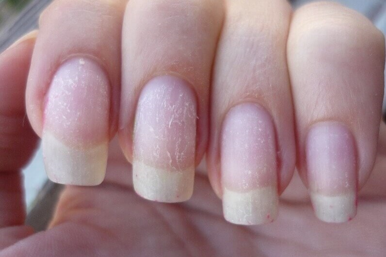 Восстановление ногтей после гель-лака