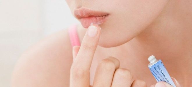 Лекарство от заедов в уголках губ